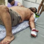 ਸ਼ਿਵ ਸੈਨਾ ਦੇ ਸ਼ਹਿਰੀ ਪ੍ਰਧਾਨ ਚੰਦਨ ਜਿੰਦਲ ’ਤੇ ਤਲਵਾਰਾਂ ਨਾਲ ਹਮਲਾ