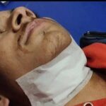 ਪਾਬੰਦੀਸ਼ੁਦਾ ਚੀਨੀ ਡੋਰ ਕਰਕੇ ਬਰਨਾਲਾ ’ਚ ਤਿੰਨ ਤੇ ਮੁਕਤਸਰ ’ਚ ਦੋ ਜ਼ਖ਼ਮੀ