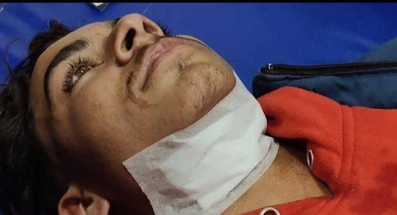 ਪਾਬੰਦੀਸ਼ੁਦਾ ਚੀਨੀ ਡੋਰ ਕਰਕੇ ਬਰਨਾਲਾ ’ਚ ਤਿੰਨ ਤੇ ਮੁਕਤਸਰ ’ਚ ਦੋ ਜ਼ਖ਼ਮੀ