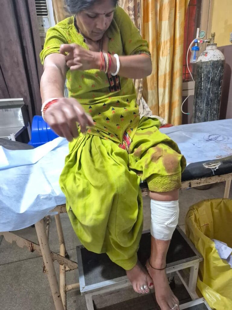 ਜਲੰਧਰ ’ਚ ਅਵਾਰਾ ਕੁੱਤਿਆਂ ਦੀ ਦਹਿਸ਼ਤ; ਇੱਕ ਮਹੀਨੇ ’ਚ 40 ਘਟਨਾਵਾਂ