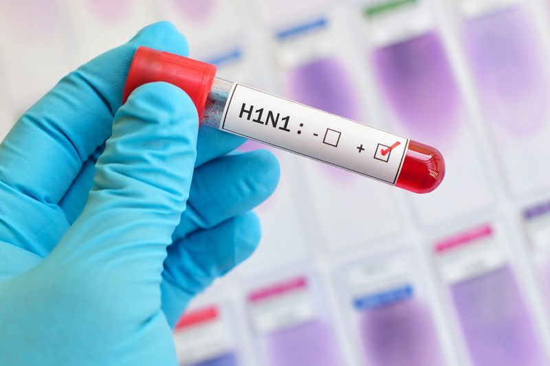 Punjab ਵਿੱਚ Swine Flu ਦੇ 70 ਮਾਮਲੇ ਸਾਹਮਣੇ ਆਏ